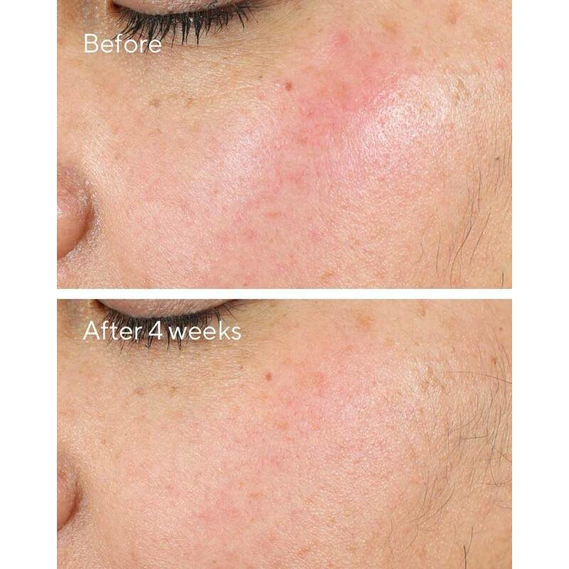 Murad compatible - Intense Recovery Cream 50 ml