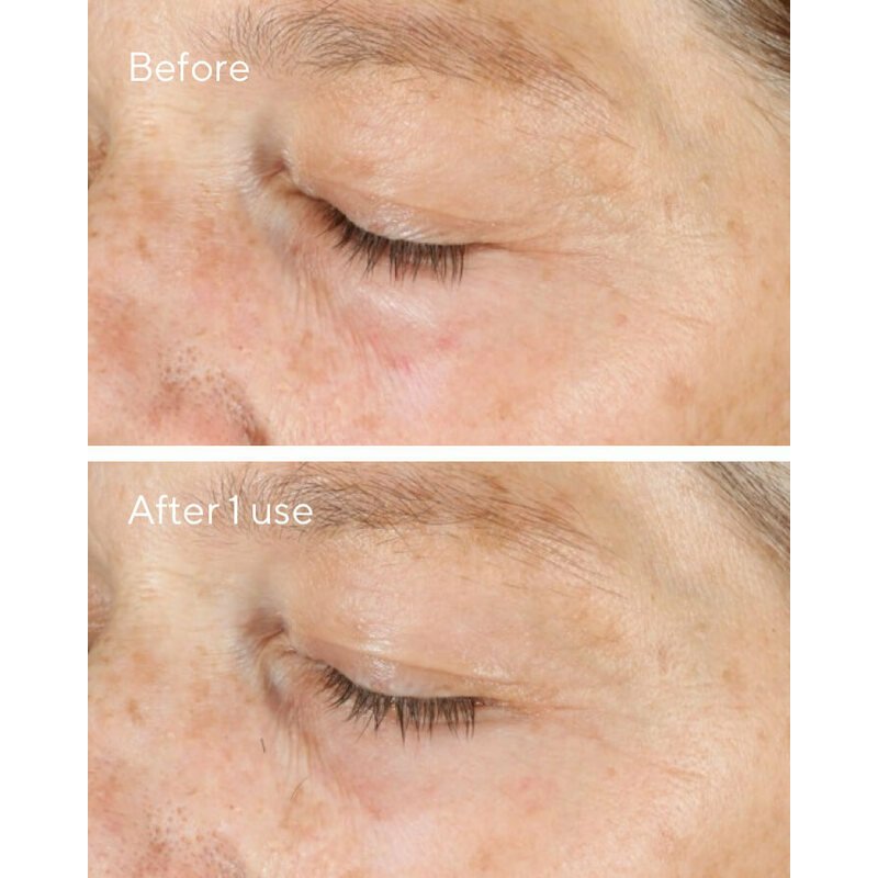 Murad Vita-C Triple Exfoliating Facial 80 ml