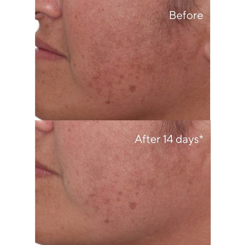 Murad - Rapid Dark Spot Correcting Serum