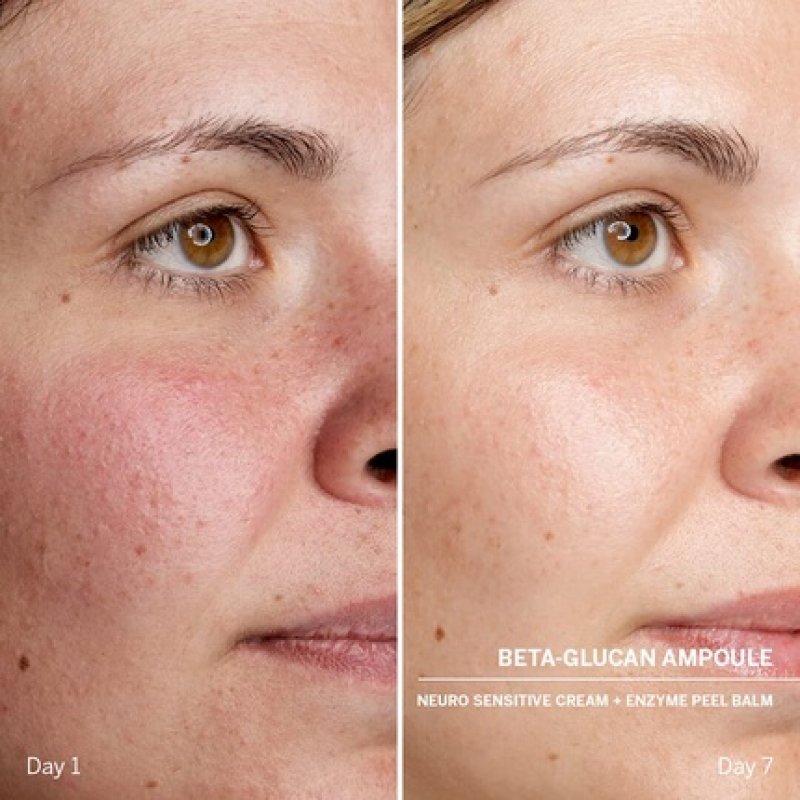 DOCTOR BABOR Power Serum Beta-Glucan Face Ampoules with Hyaluronic Acid 7 x 2ml