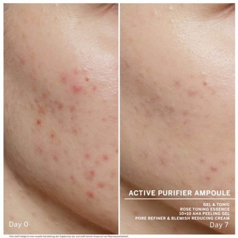 BABOR Active Purifier Face Serum Ampoules with Tea Tree Oil for Reduced Impurities 2ml