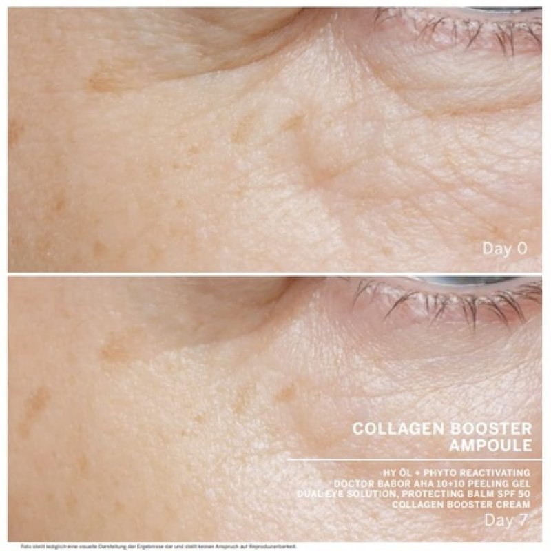 BABOR Collagen Booster Anti-Aging Serum Ampoules for Face with Tripeptide for Elasticity and Smoothness 7x2ml