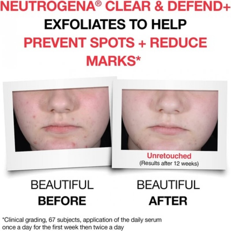 Neutrogena Clear and Defend Face Serum 30ml