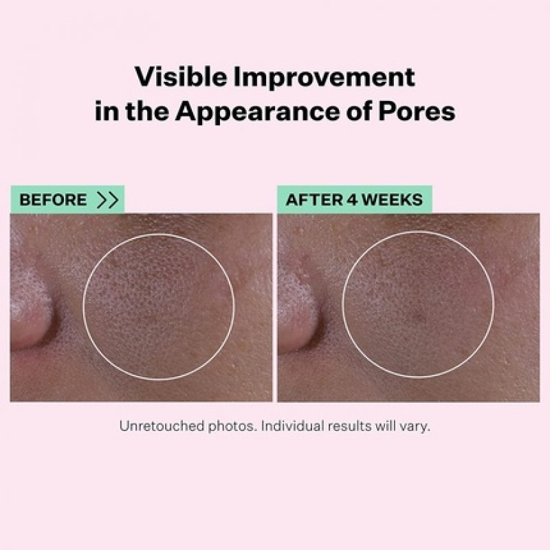 StriVectin Super Shrink Pore Minimizing Serum for Clogged Pores and Blackheads Tightening and Brightening Skin Texture