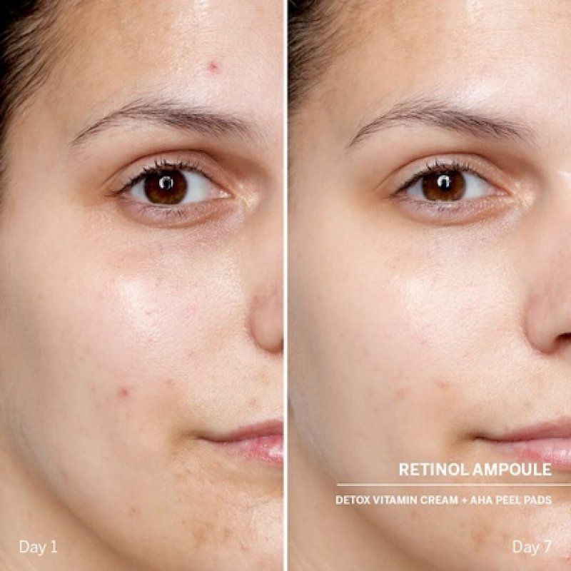 DOCTOR BABOR Power Serum Retinol Face Ampoules with Hyaluronic Acid and Anti-Aging Retinol - 7 x 2ml