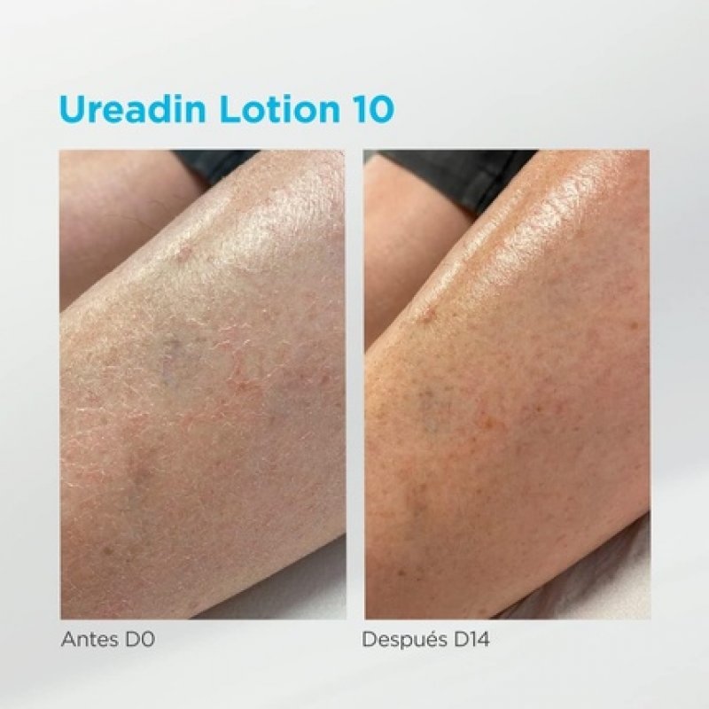 UREADIN Moisturising Lotions 400g