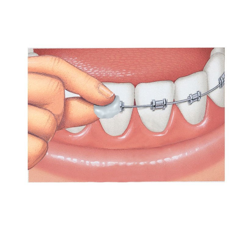 GUM 6056792 Cire orthodontique 1 pièce(s)