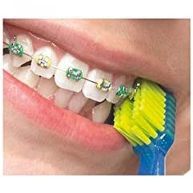 Curaprox Ortho Box ORTHORETAIL