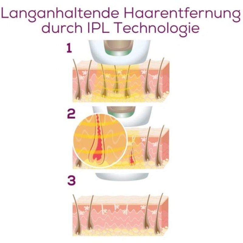 Beurer IPL Velvet Skin Pro Hair Removal Device with Battery, Permanent Hair Removal with IPL Technology for Body, Face,