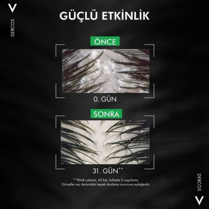 Vichy Dercos Anti-Dandruff Advanced Action Shampoo Normal to Oily Hair 390ml