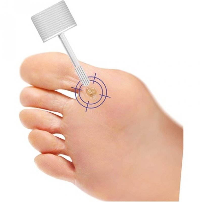 Dermovitamin Micoblock Wart Remover 2ml