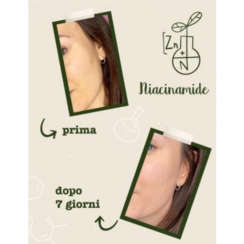 La Saponaria Niacinamide Zinc Serum for Combination Skin and Blemished Skin