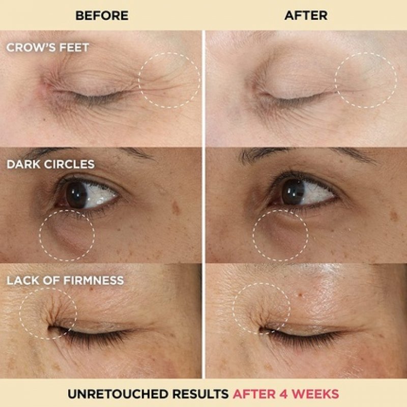 IT Cosmetics Confidence in an Eye Cream Anti Aging Eye Cream for Dark Circles Crow's Feet Lack of Firmness & Dryness