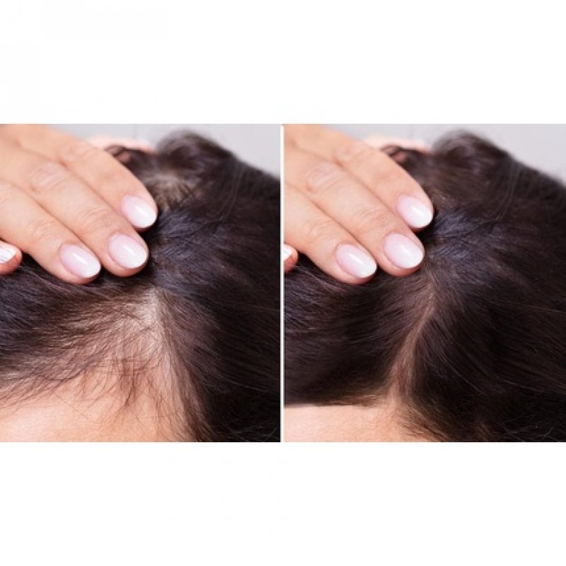 Herbaria Banfi Nettle Shampoo for Normal Hair Herbal Moisturising 250ml