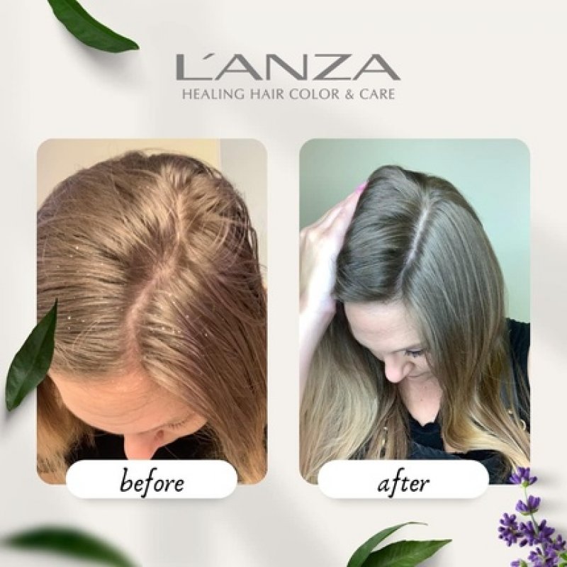 L'ANZA Healing Remedy Balancing Conditioner 250ml with Papaya Extract - Sulfate, Paraben, and Gluten Free