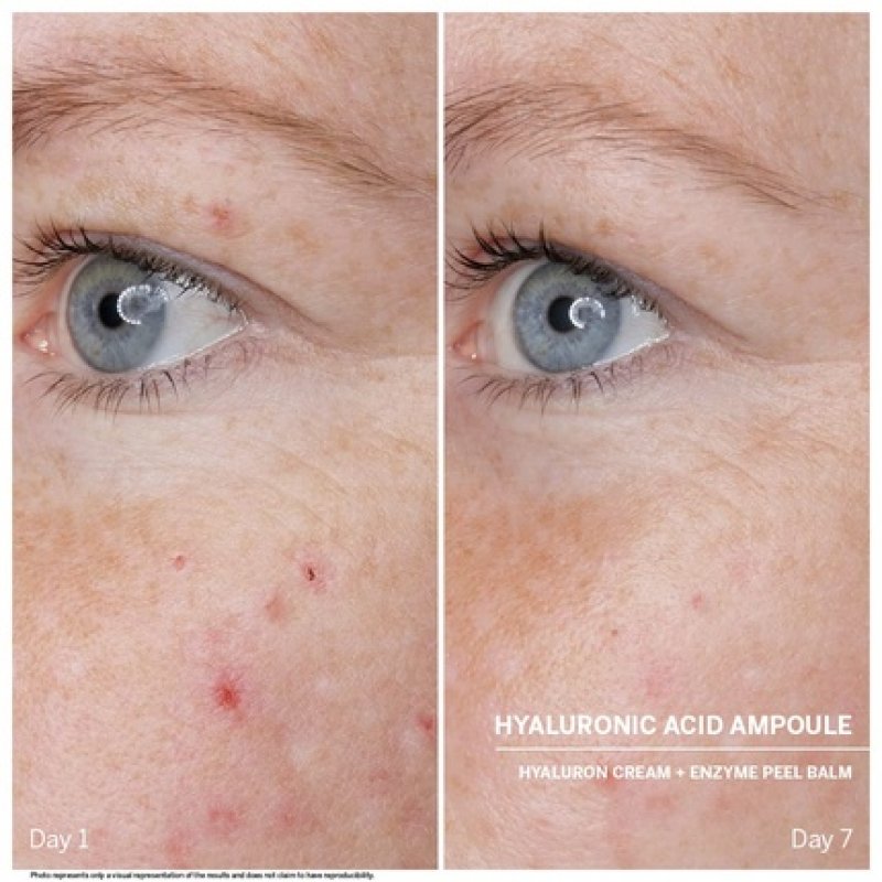 DOCTOR BABOR Power Serum Hyaluronic Acid Face Ampoules with Tripeptides for Intensive Moisture 7x2ml