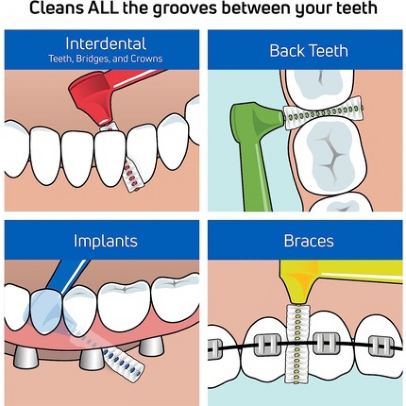 TePe Interdental Angle Green Surgery 0.8mm - Pack of 25