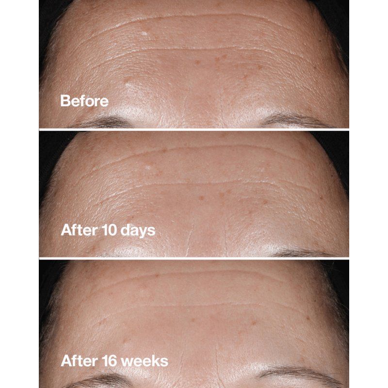 Clinique Smart Custom-Repair Wrinkle Correcting Serum 50 ml