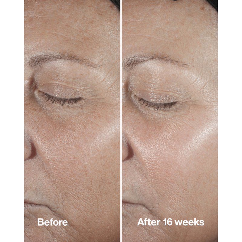 Clinique Smart Custom Repair Concentrate Serum 1.7oz 50ml