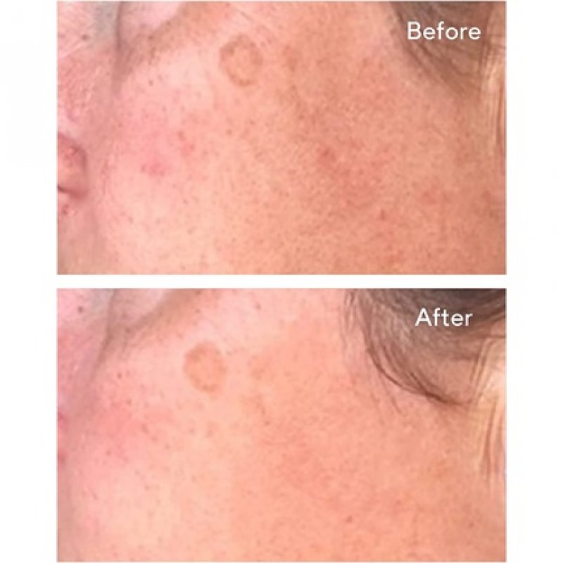 Murad Environmental Shield Correct & Protect Serum Spf 45 30ml