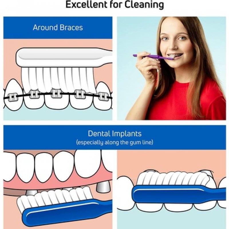 TEPE Implant Orthodontic Brush for Cleaning Near Implants and Orthodontic Wires