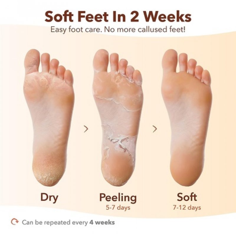 Purederm Exfoliating Foot Mask Papaya & Chamomile Extract - Sock Type - Peel Away Calluses and Dead Skin Cells in 2