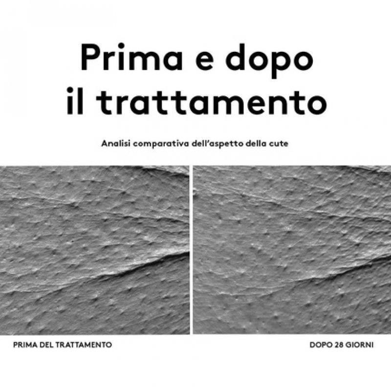 Korff Eye Zone Eye Contour Bags Glasses with Hyaluronic Acid and Vitamin PP Anti-Wrinkle Moisturizer 15ml