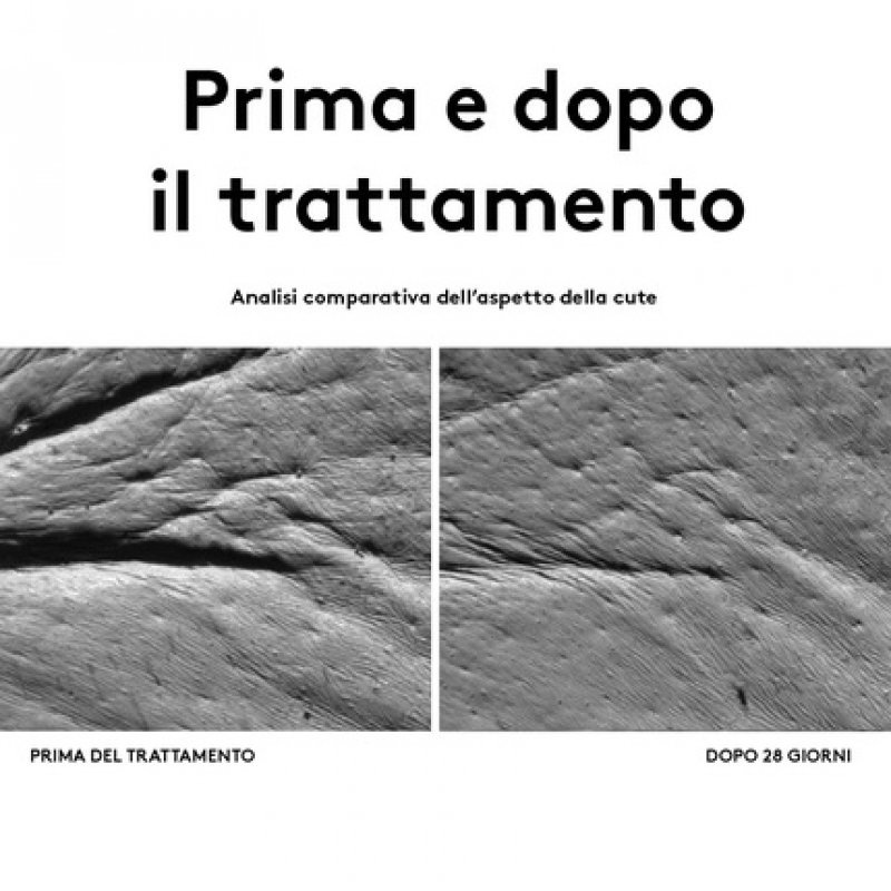 Korff Eye Zone Contour Eye Bags and Eyes with Hyaluronic Acid and Vitamin PP Lifting and Highlighter Effect 15ml