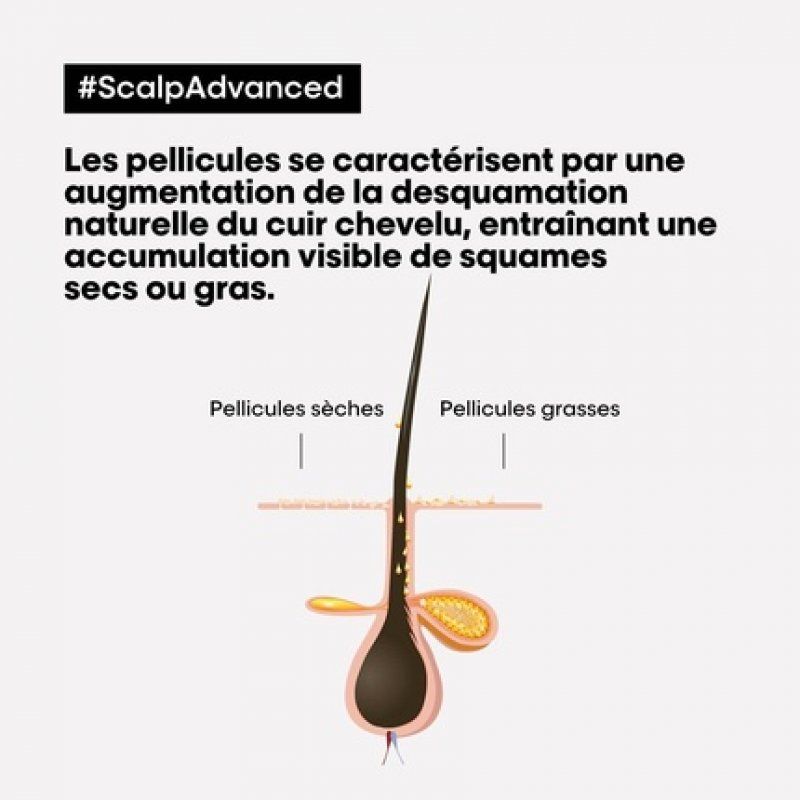 LP SE Scalp A-Dndrf Shp R 500ml   Inst clear