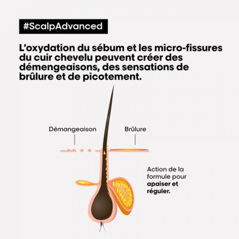 LP SE Scalp A-Discf Shp R 500ml    Sensibalance