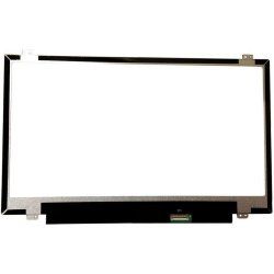 14-inch HD anti-glare display