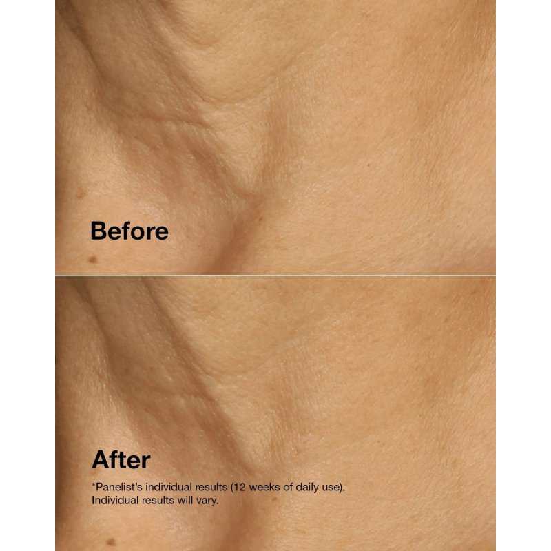 Clinique Smart Clinical Repair Lifting Face Neck Cream Crèmes de jour et de nuit Visage, Cou 50 ml