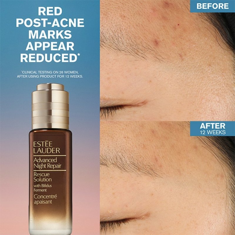 Estee Lauder Advanced Night Repair Rescue Solution Serum 20ml