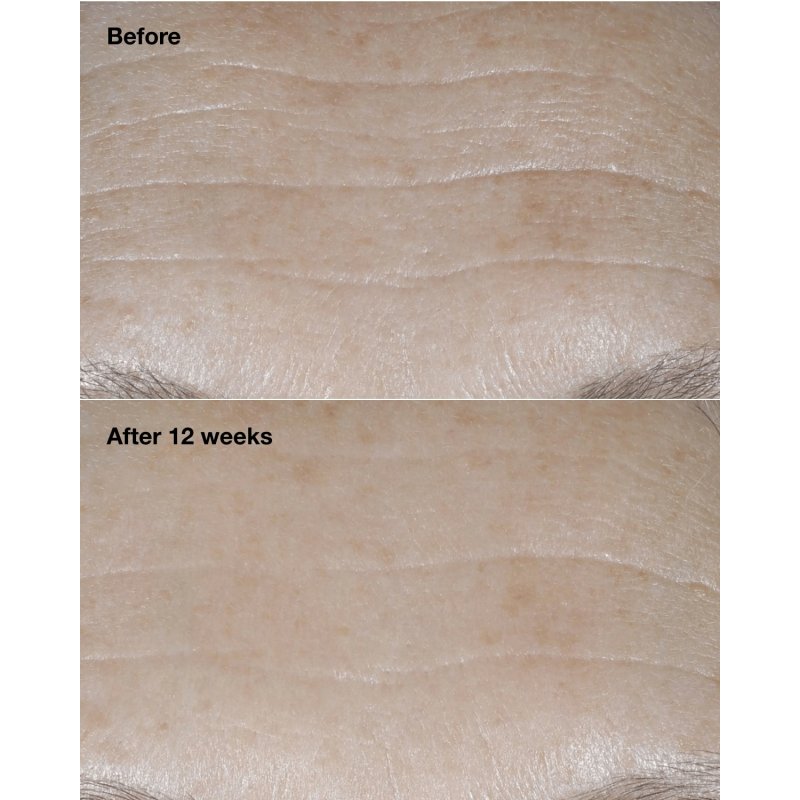 CLINIQUE Smart Clinical Repair Anti-Wrinkle Correction Cream SPF30 50ml