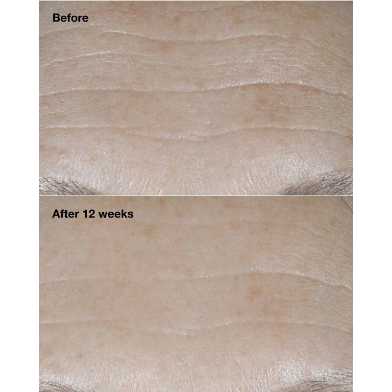 Clinique Smart Clinical Repair Broad Spectrum SPF 30 Wrinkle Correcting Cream 50 ml