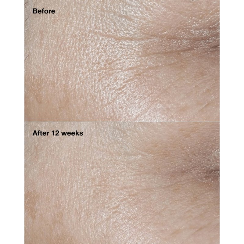 CLINIQUE Smart Clinical Repair Anti-Wrinkle Correction Cream SPF30 50ml