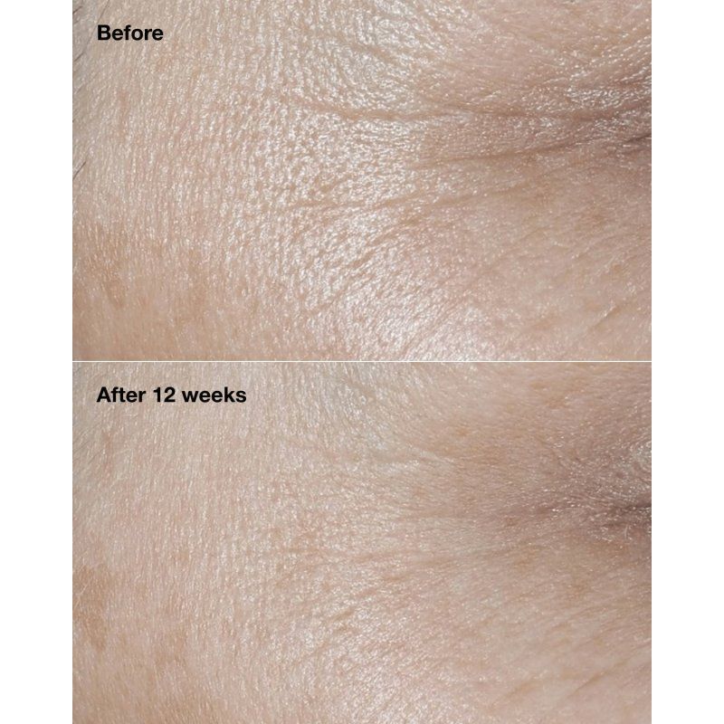 Clinique Smart Clinical Repair Broad Spectrum SPF 30 Wrinkle Correcting Cream 50 ml