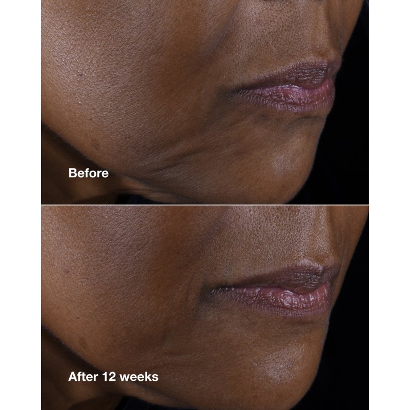 Clinique Clinique Smart Clinical Repair Firming Cream For Face And Neck 75ml