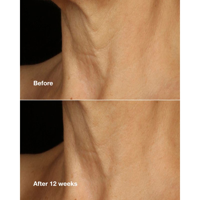 Clinique Smart Clinical Repair Lifting Face Neck Cream 75 ml