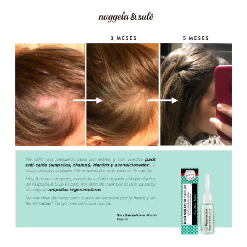 Nuggela & Sulé Hair Regenerator Treatment 10ml - With Powerful Active Ingredients - Regenerates Hair and Stimulates