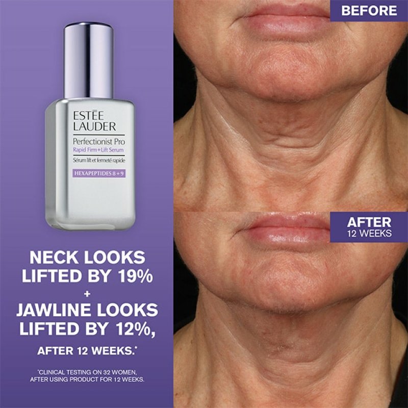 Estée Lauder Perfectionist Pro Rapid Firm Lift Serum 30ml