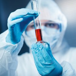 HYGOSTAR Gant de protection chimique SUPER HIGH RISK, XL