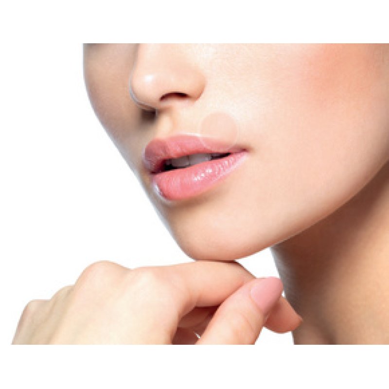 Lifemed Patch contre les boutons de fièvre, transparent