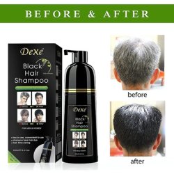 Dexe Black Hair Shampoo 400ml Instant Hair Darkening Dye for Men and Women