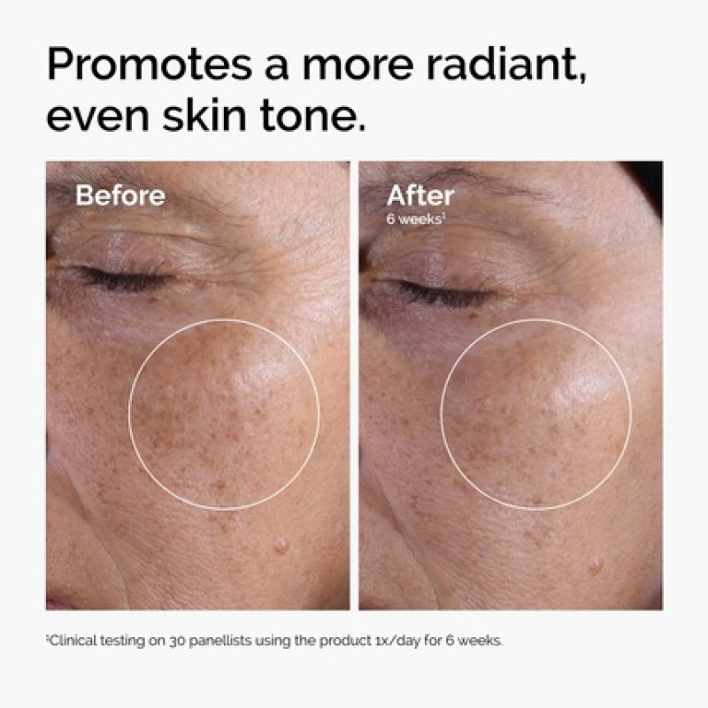 The Ordinary Glycolic Acid 7% Exfoliating Toner - Brightening and Smoothing Daily