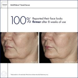 Obagi ELASTIderm Facial Serum with Bi-Mineral Contour Complex 1.0 oz