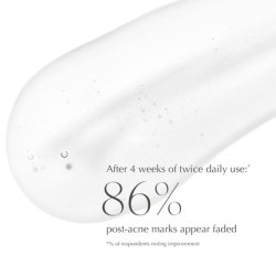 EXUVIANCE Clarifying and Renewing Serum with Niacinamide NeoGlucosamine and Licorice Root Extract for Oily Skin 1fl oz