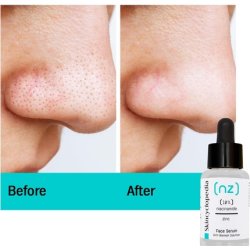 Skincyclopedia 10% Niacinamide Serum Hyperpigmentation and Acne Scar Treatment Pore Minimizer for Oily Skin 30ml
