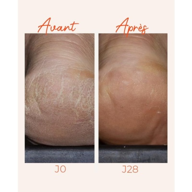 Alvadiem Intense Dry & Fragilized Feet Protective Treatment 100ml