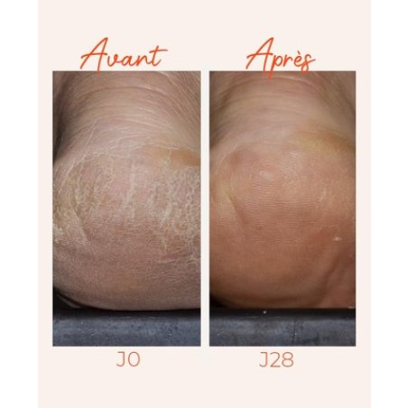 Alvadiem Intense Dry & Fragilized Feet Protective Treatment 100ml